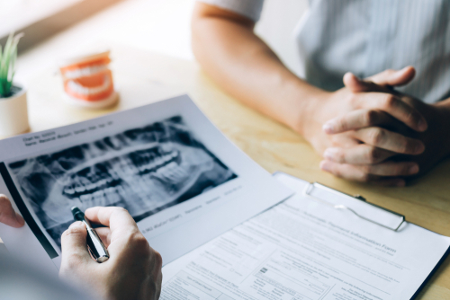 What To Do With a Chipped Off Back Tooth