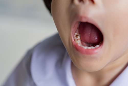 How Old Should My Child Visit The Dentist?