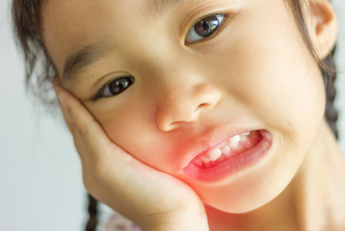 How Common is Tooth Chipping