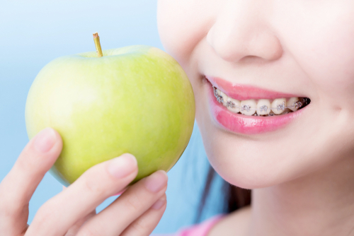 Eating with Braces Foods to Enjoy and Avoid