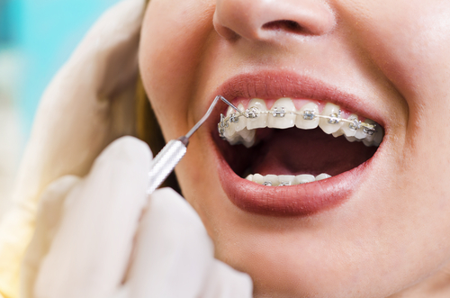 Regular Orthodontic Checkups