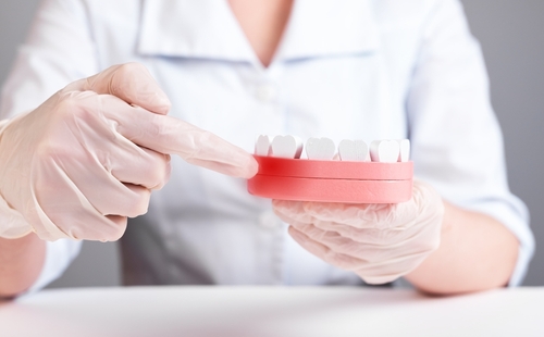 Secondary Effects on Oral Health