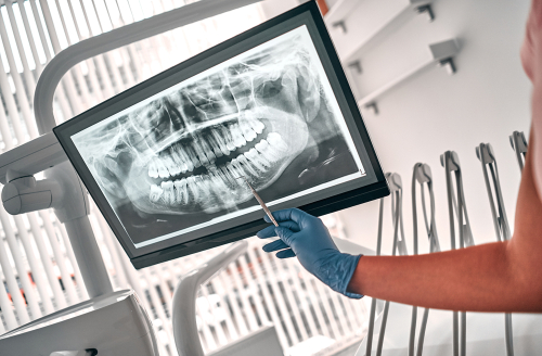 Common Dental Problems and How to Prevent Them